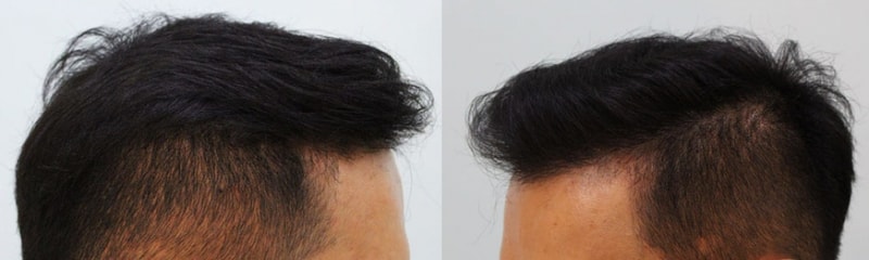 수술전1.jpg