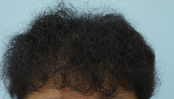 1차 후.JPG