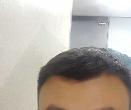 수술하기전에.jpg