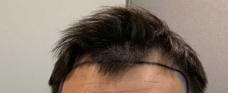 수술직전에.3.jpg