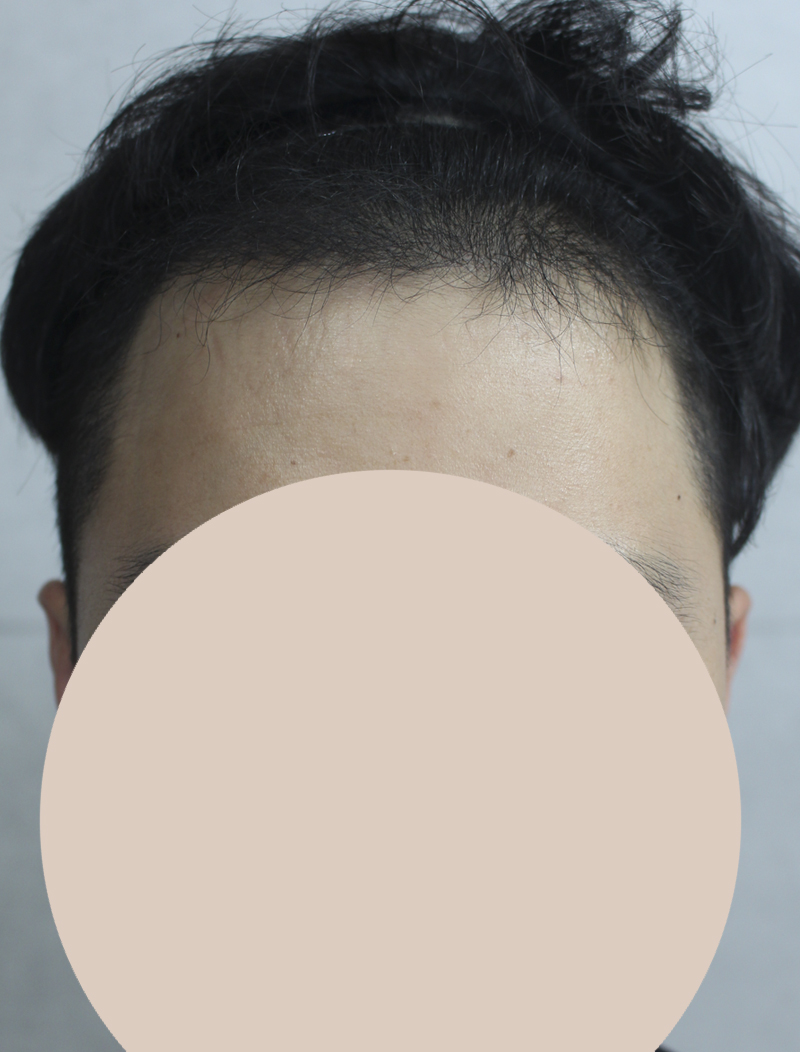 봉봉로봉봉 1.jpg