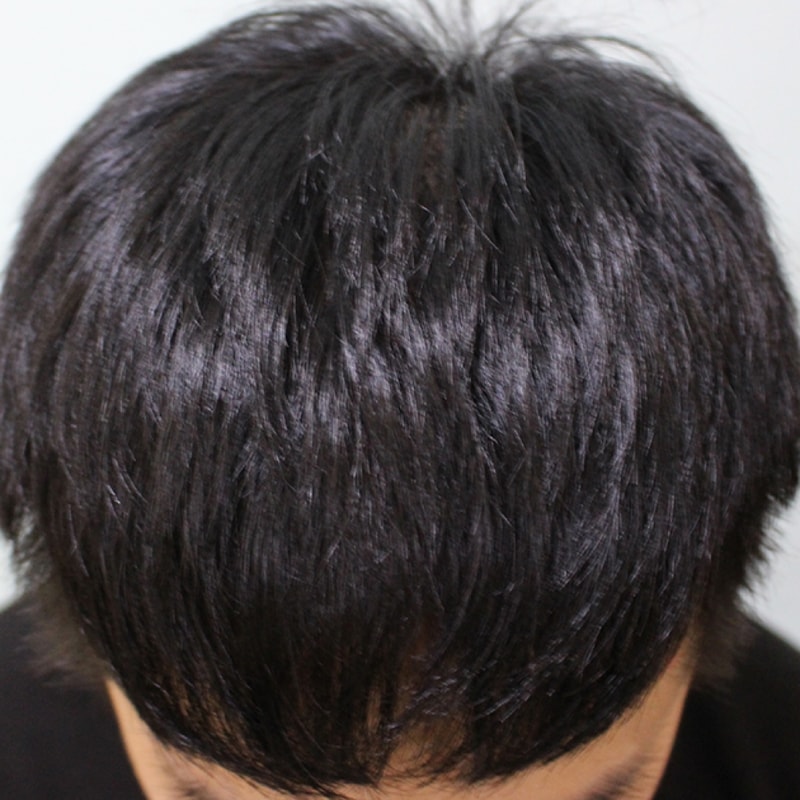 수술후 10일 (12).JPG