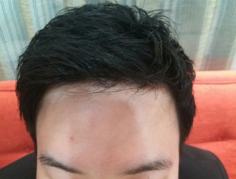 수술후3.jpg