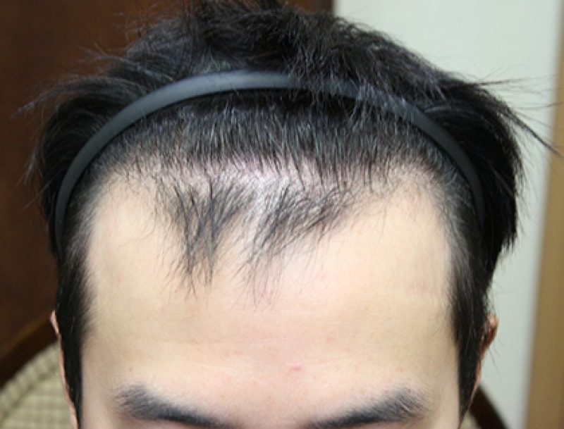 수술전정면.jpg