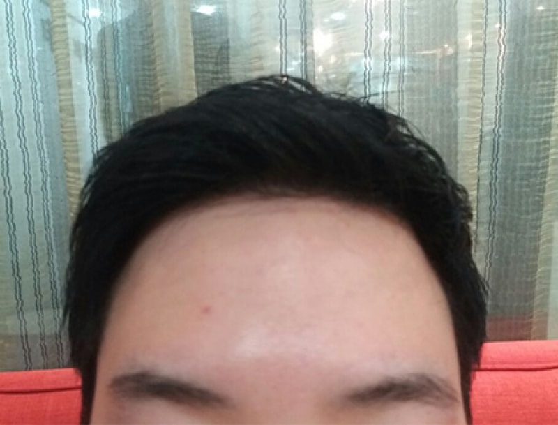 수술후1.jpg