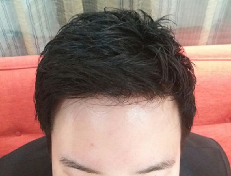 수술후2.jpg