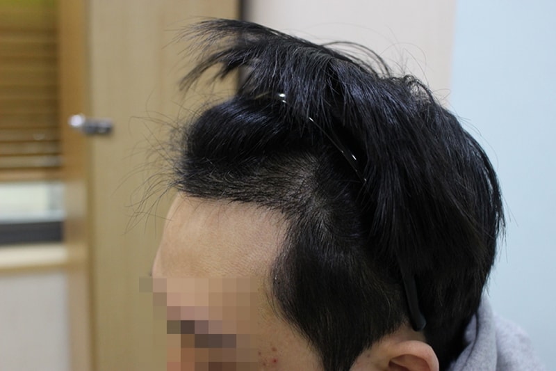 후 (1).JPG