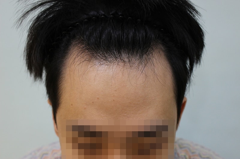 전 (2).JPG