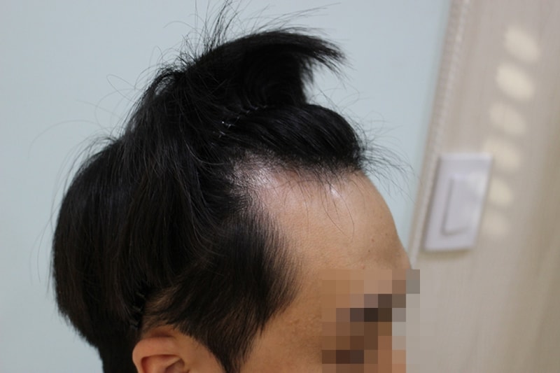 전 (1).JPG