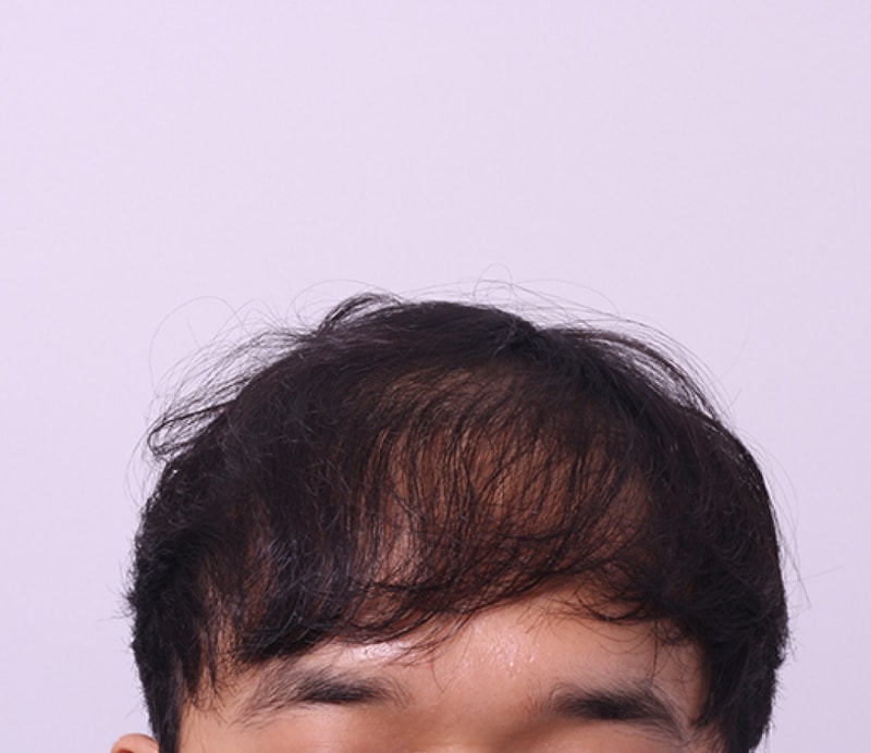 수술전1.jpg