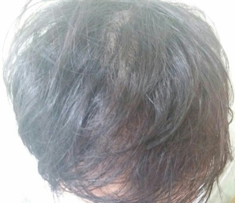 수술후2.jpg
