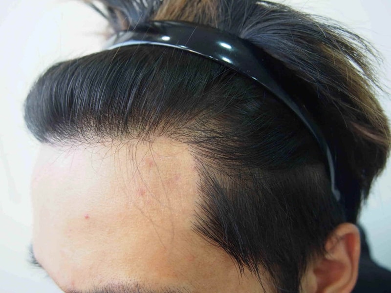 크기변환_크기변환_1년 2.JPG