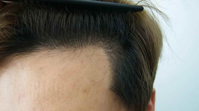 크기변환_7개월 1.jpg