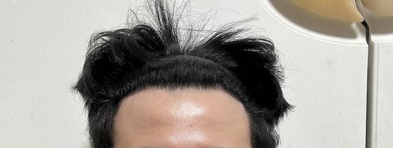 풀소유 다나 14개월 무삭발 경과