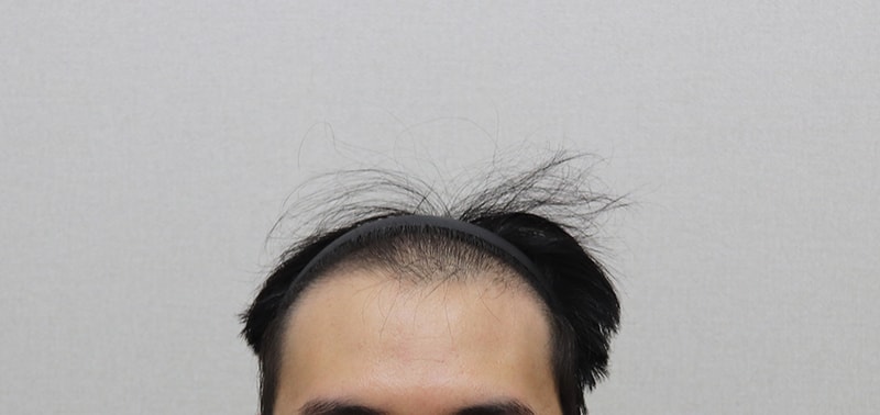 1IMG_1248수술전.JPG