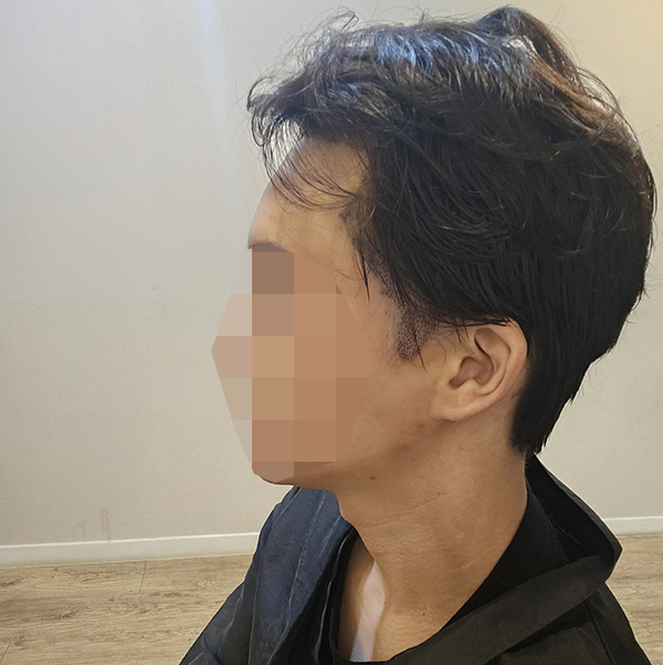 10-2800모는 부분삭발 1000모는 무삭발로 해서 뒷머리 티가 거의 안나요.jpg
