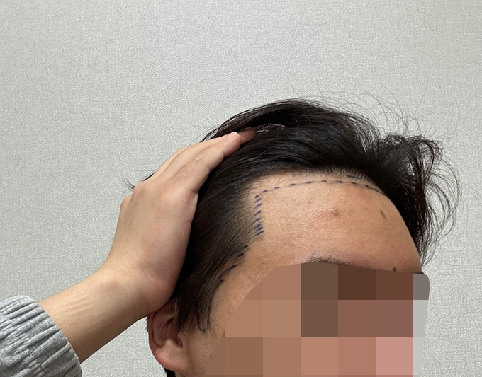 3-디자인후.jpg