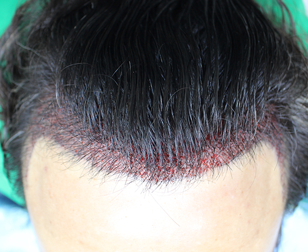 3.JPG