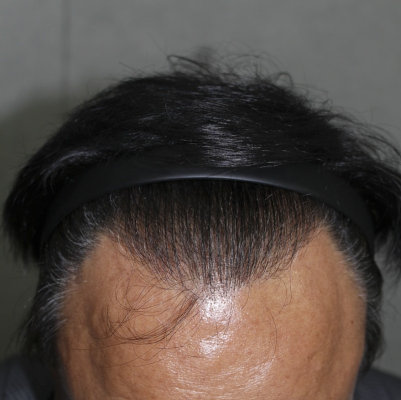 IMG_6677_9개월.png