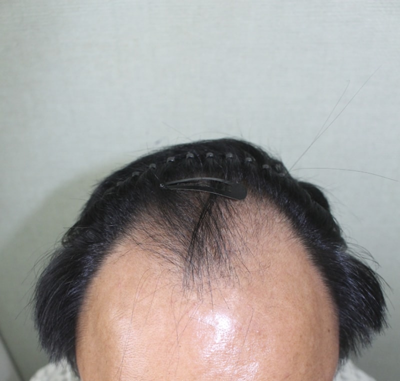 이 중보_20160923_모발_49619.png