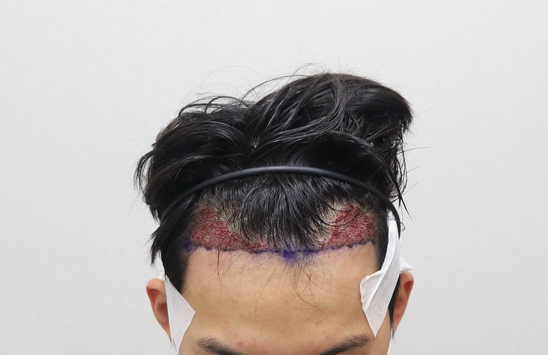 수술후.jpg