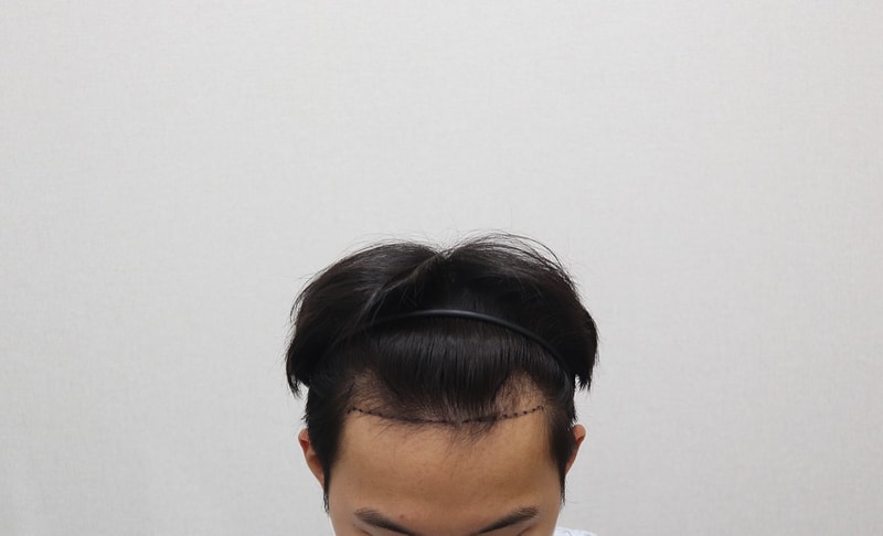 디자인_후.jpg