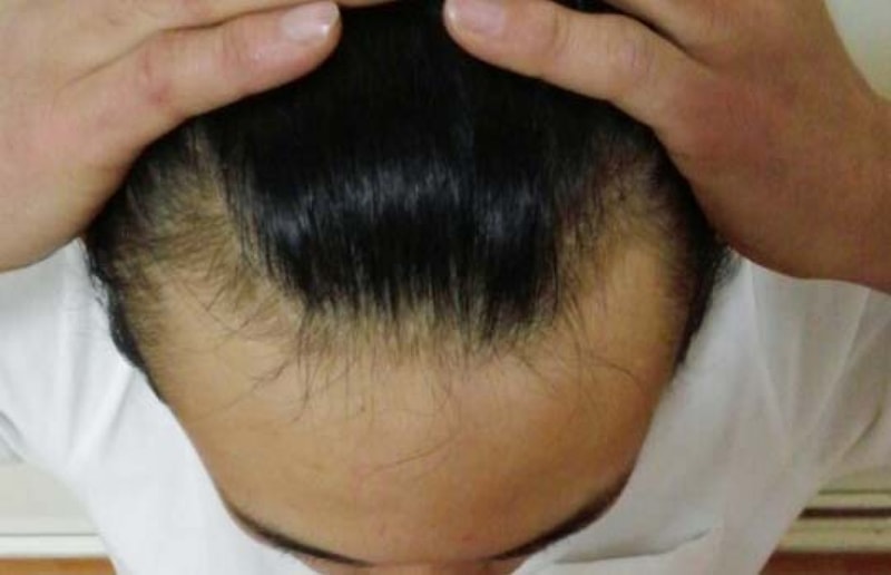 상담직전 고민.jpg