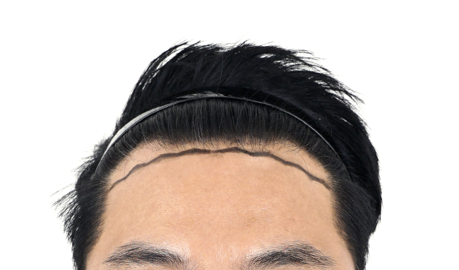 1.png