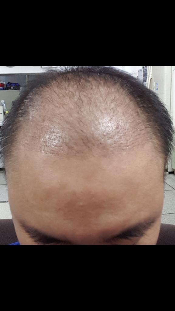 다크시간 지나갔으면 좋겠습니다