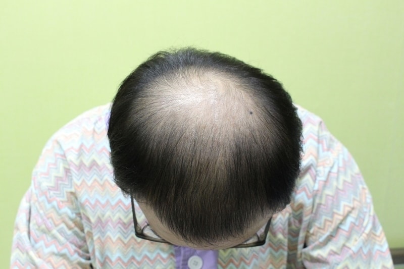 수술전 탑.jpg