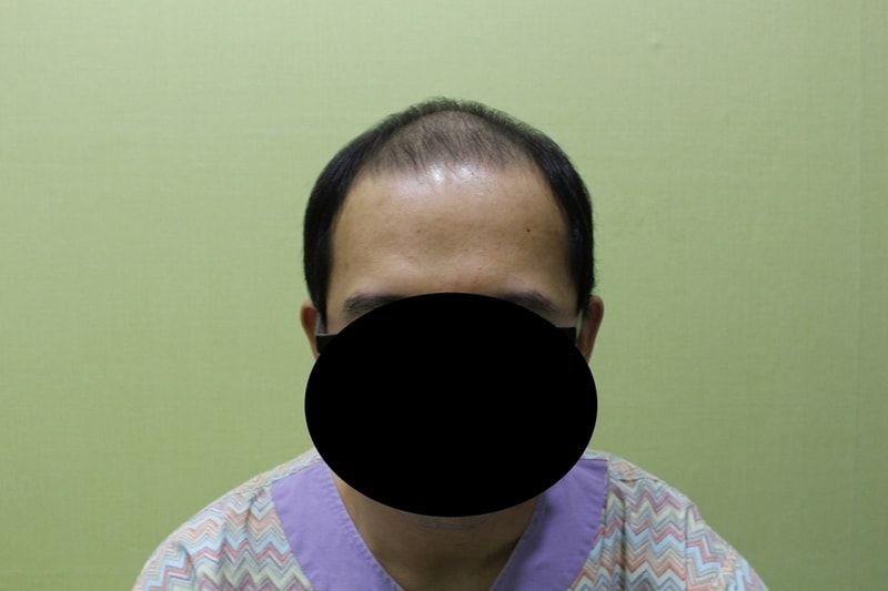 수술전 프론트.jpg
