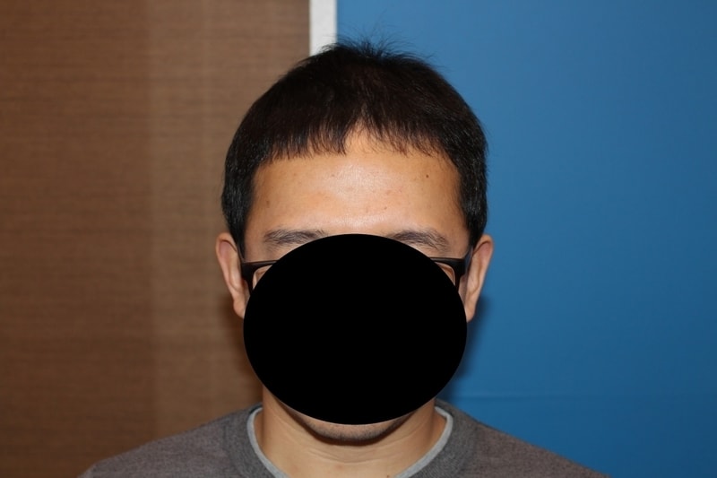 수술후 프론트.jpg