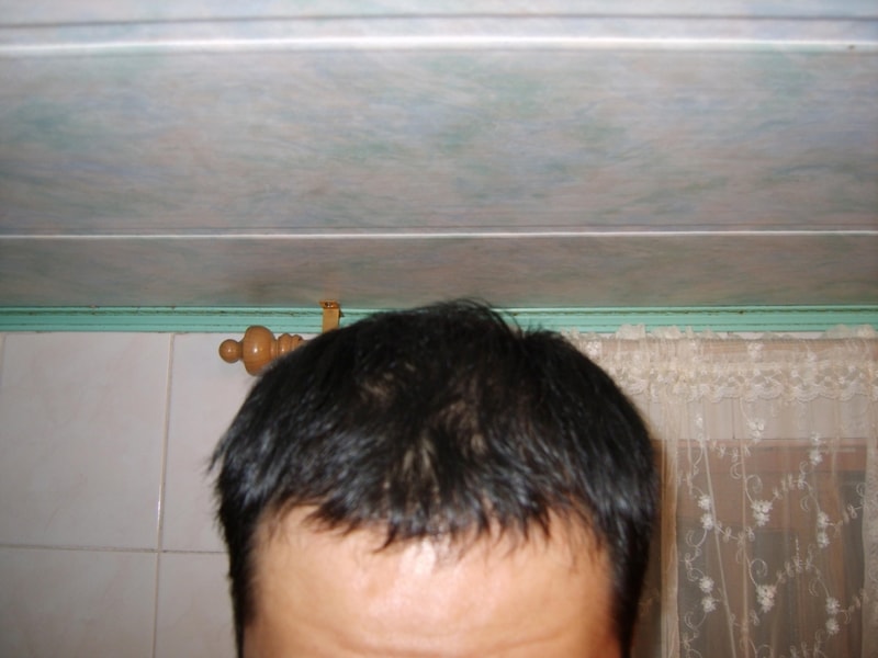 수술후1.JPG