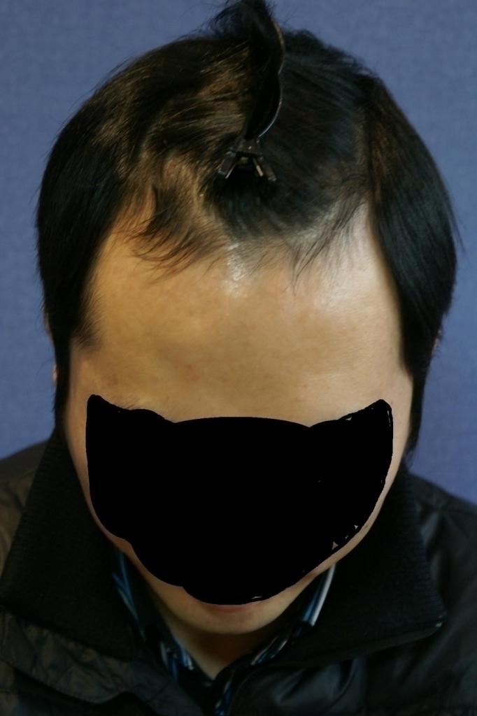 수술전.JPG