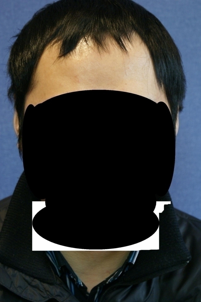 수술전2.JPG