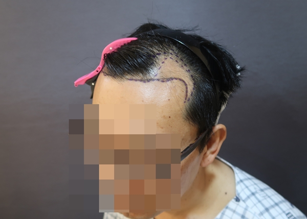 수술전_2.jpg