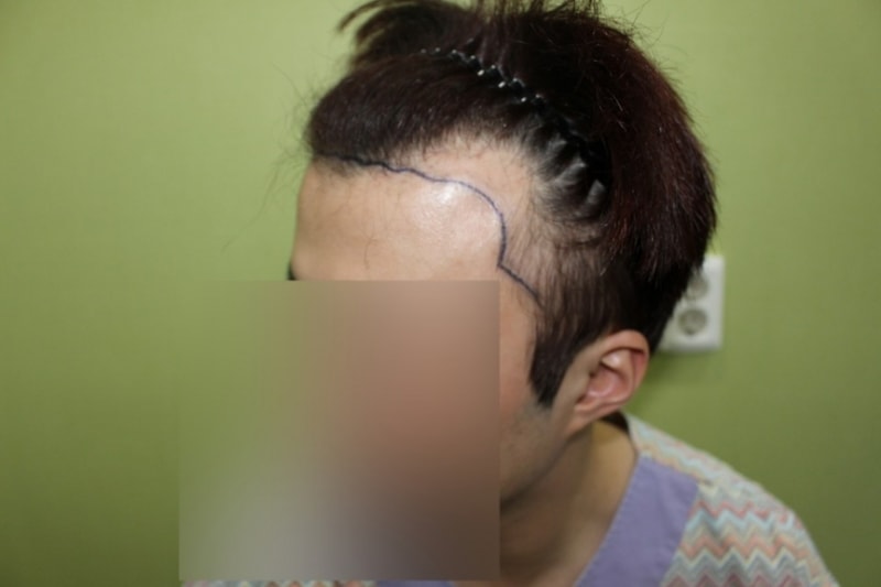수술당일 4.jpg