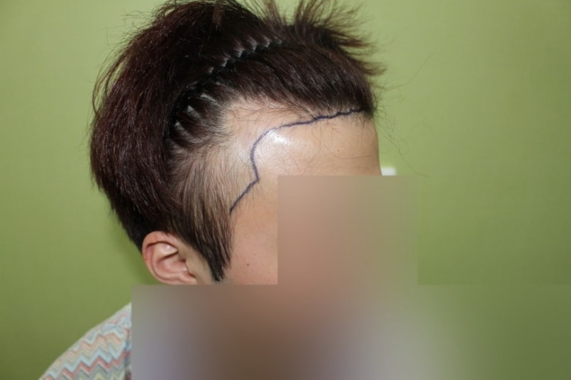 수술당일 3.jpg