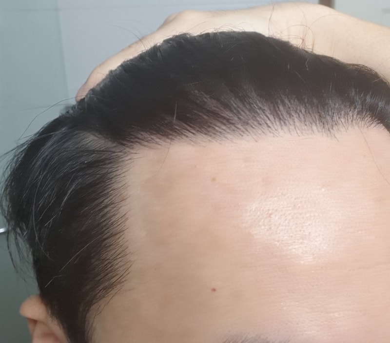 측면2.jpg