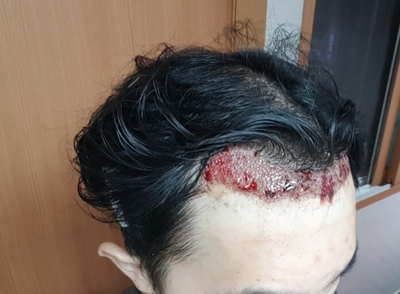 KakaoTalk_20180904_224857971.jpg