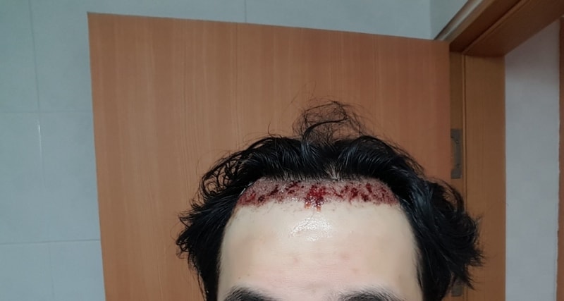 KakaoTalk_20180904_224859178.jpg