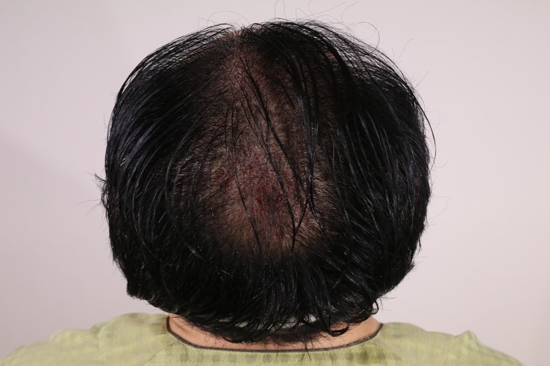 204-2023년06월08일 수술후.jpg