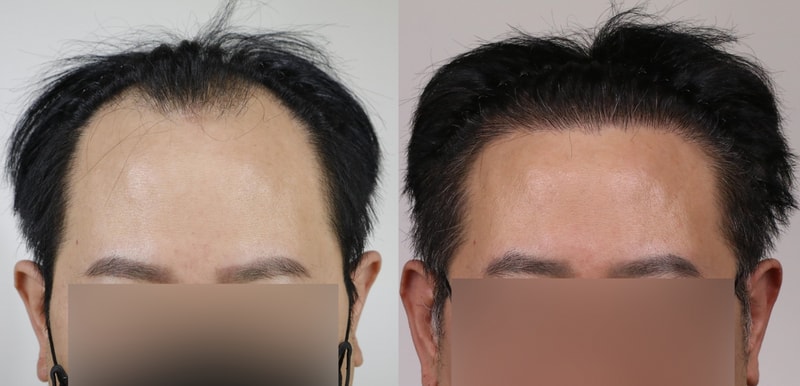 모우림1.png