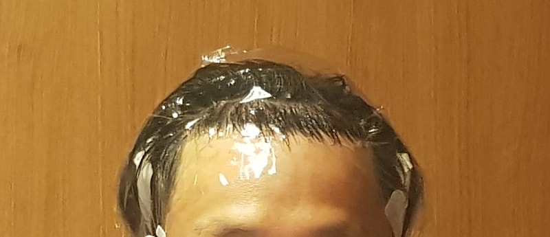 수술 후 당일8.jpg