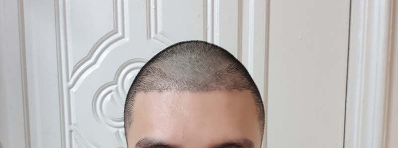 3.jpeg