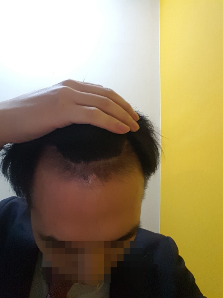 1달.jpg