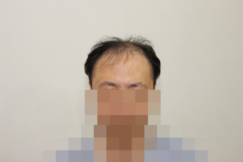 전 (1).JPG