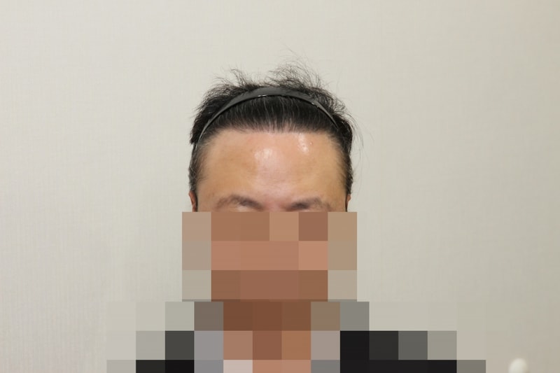 후 (1).JPG