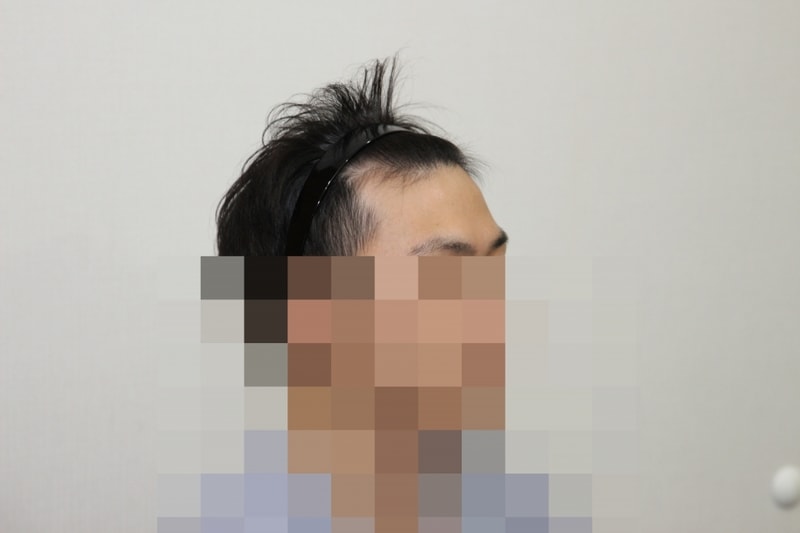 전 (3).JPG