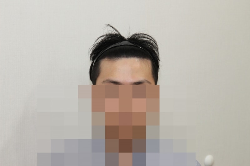 후 (1).JPG